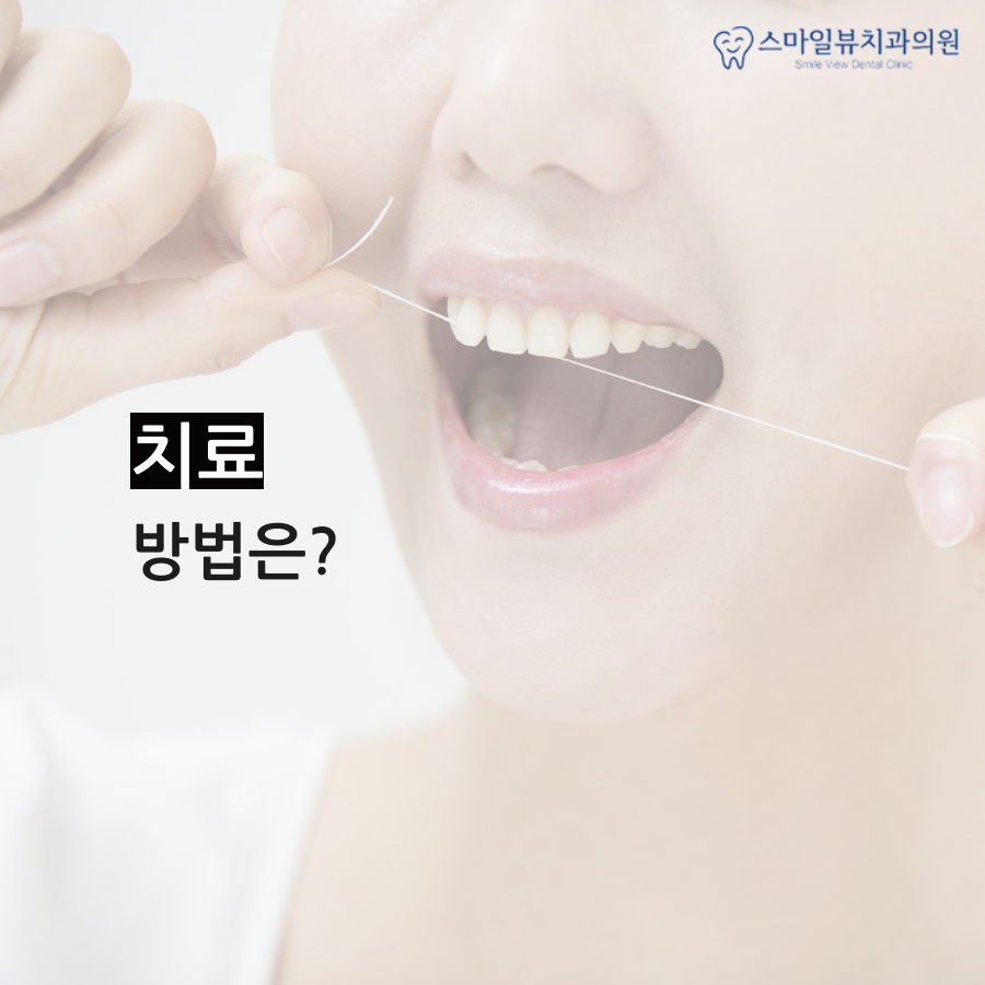 신논현역앞니충치 개선이 시급할 때 관련 이미지 4