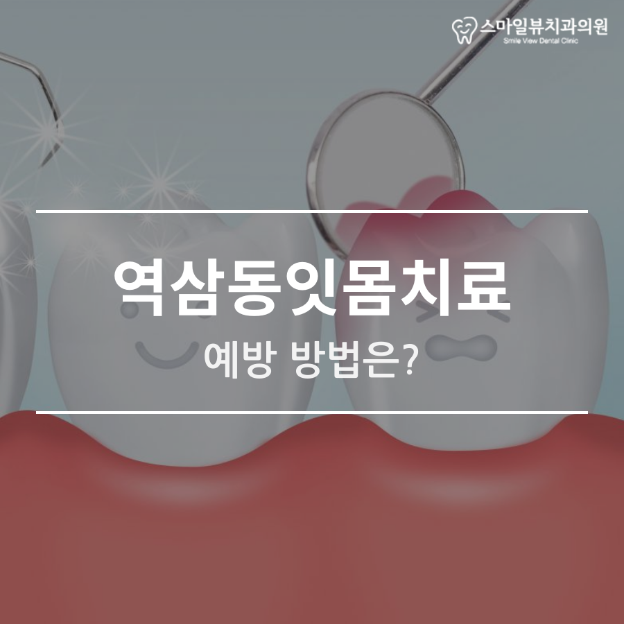 역삼동잇몸치료 예방 방법은? 관련 이미지 1