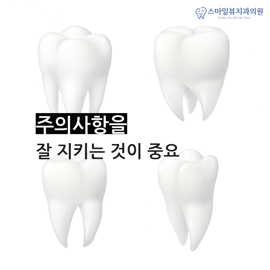 신논현역치과잘하는곳 나에게 맞는 치료법은? 관련 이미지 4