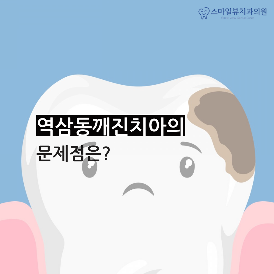 역삼동깨진치아 방치할 경우 문제점 관련 이미지 2