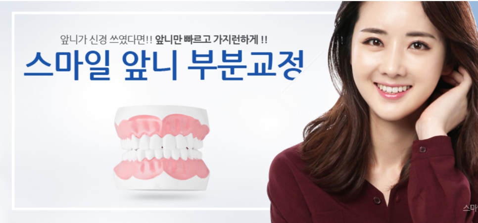 신논현역치과 부분교정잘 하는 치과 관련 이미지 3