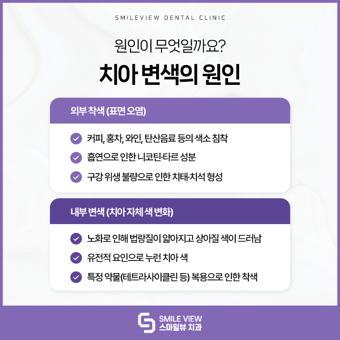 Seoul Teeth Whitening: Why does a bright impression get overshadowed, and why do teeth gradually turn yellow? image 2