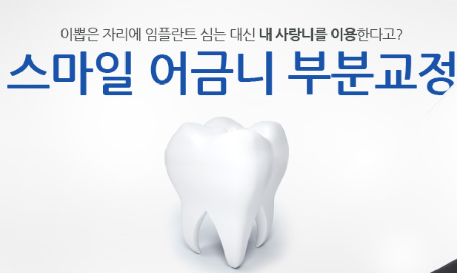신논현역치과 부분교정잘 하는 치과 관련 이미지 7