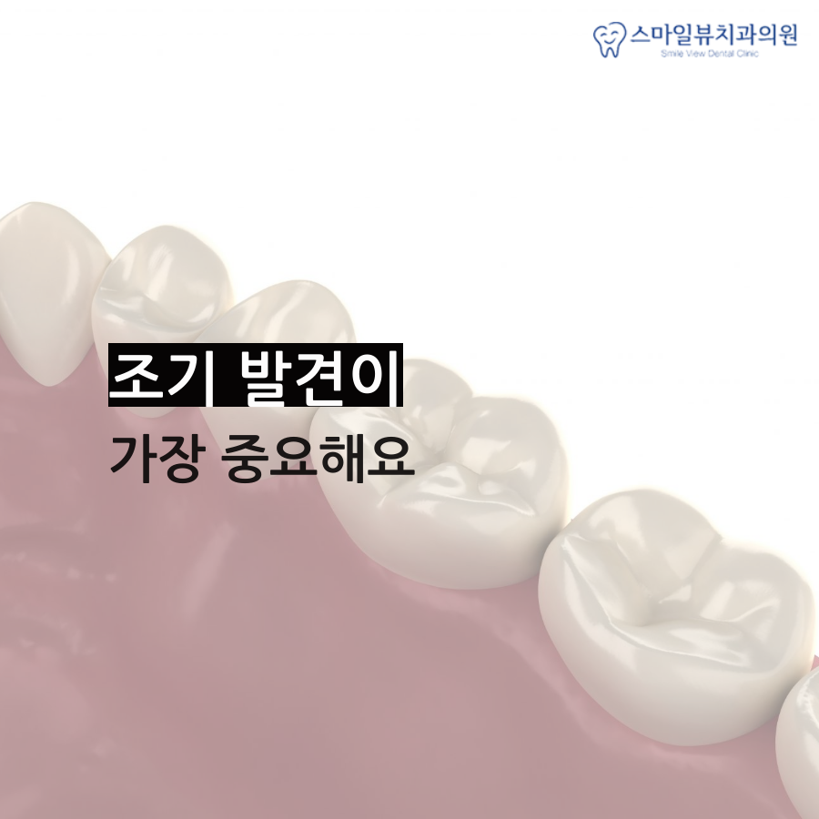 역삼동치아크라운 신경으로 가기 전에 관련 이미지 3