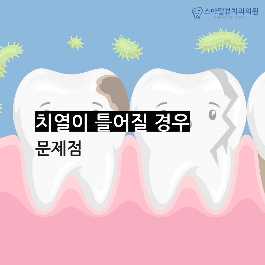 신논현역치과주걱턱 치아교정 치료 관련 이미지 2