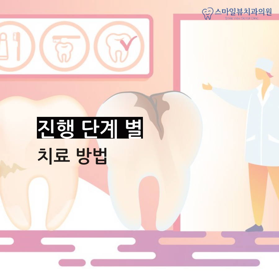 역삼치과충치 주기적인 검진 중요성 관련 이미지 3