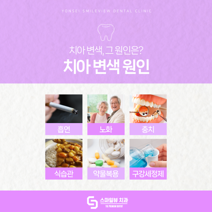 강남치아미백 누런 치아 개선해 보세요. 관련 이미지 4