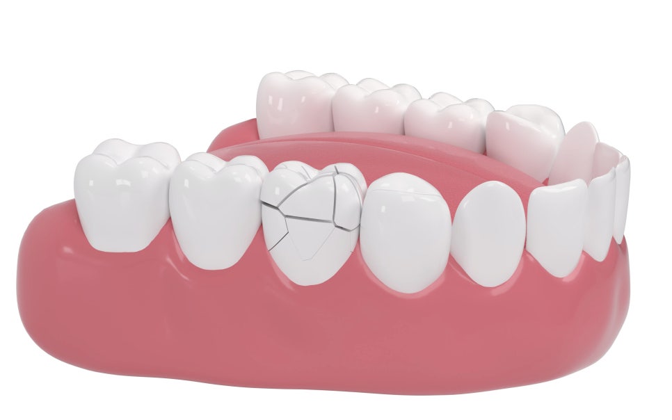 Aesthetic Dentistry, image 3