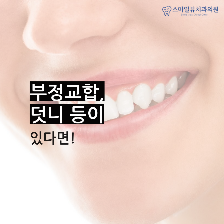신논현아래턱교합 치료 방법은? 관련 이미지 2