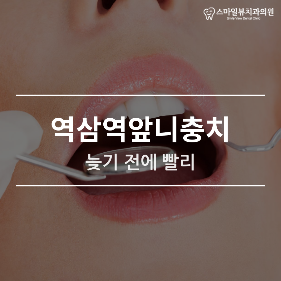 역삼역앞니충치 늦기 전에 빨리 관련 이미지 1