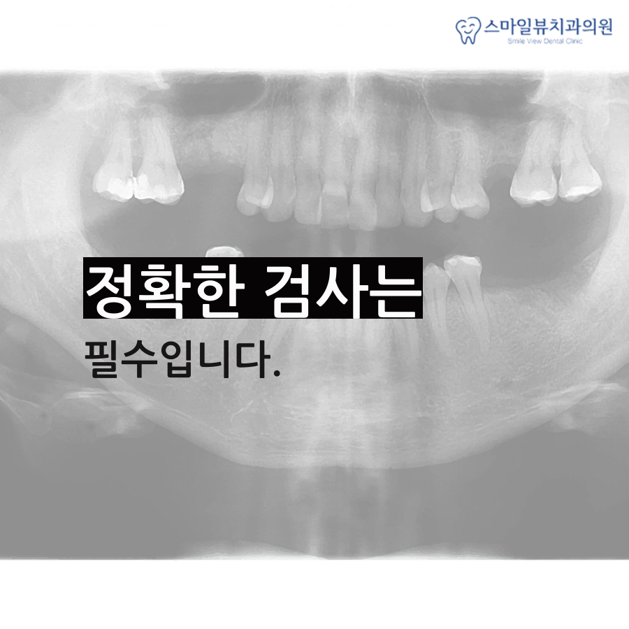 강남영구치교정 시기에 맞춰 진행해요! 관련 이미지 4