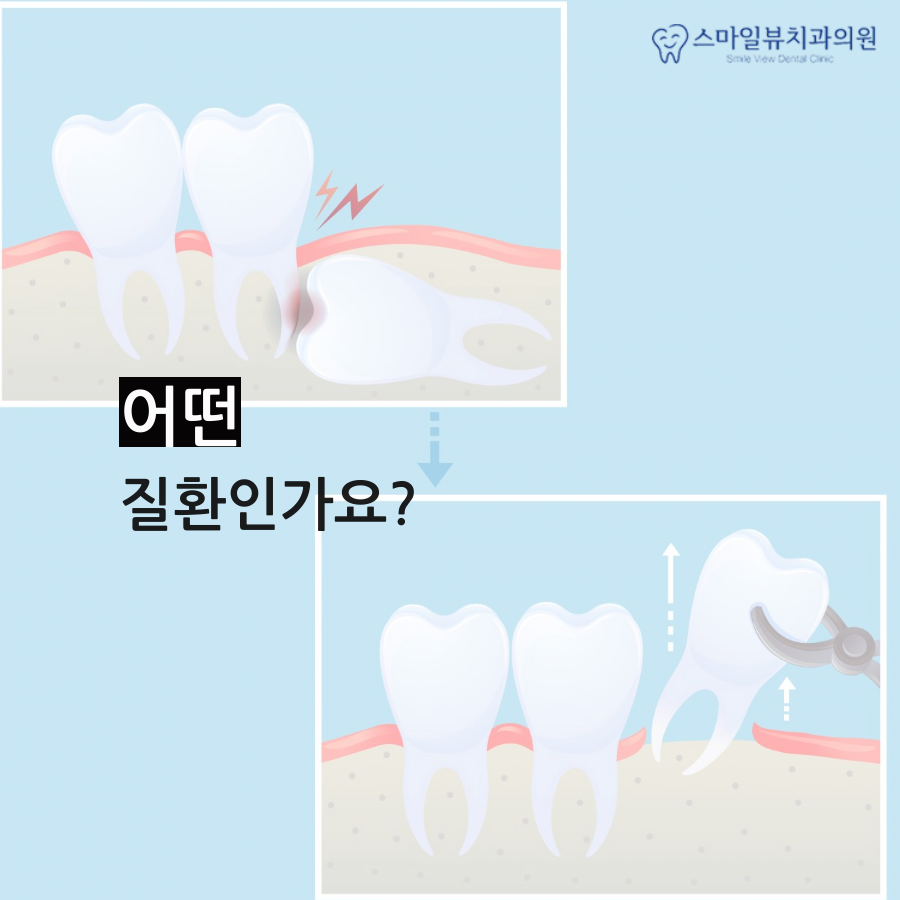 강남역치과치통 빠르게 치료해요 관련 이미지 2