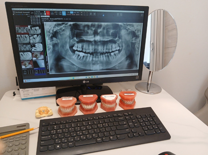Petit Tooth Reshaping Aesthetic Treatment: Check This Before Reviews image 4