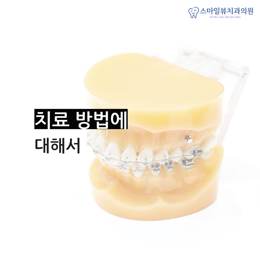 강남치과심한주걱턱 어떻게 치료하나요? 관련 이미지 4