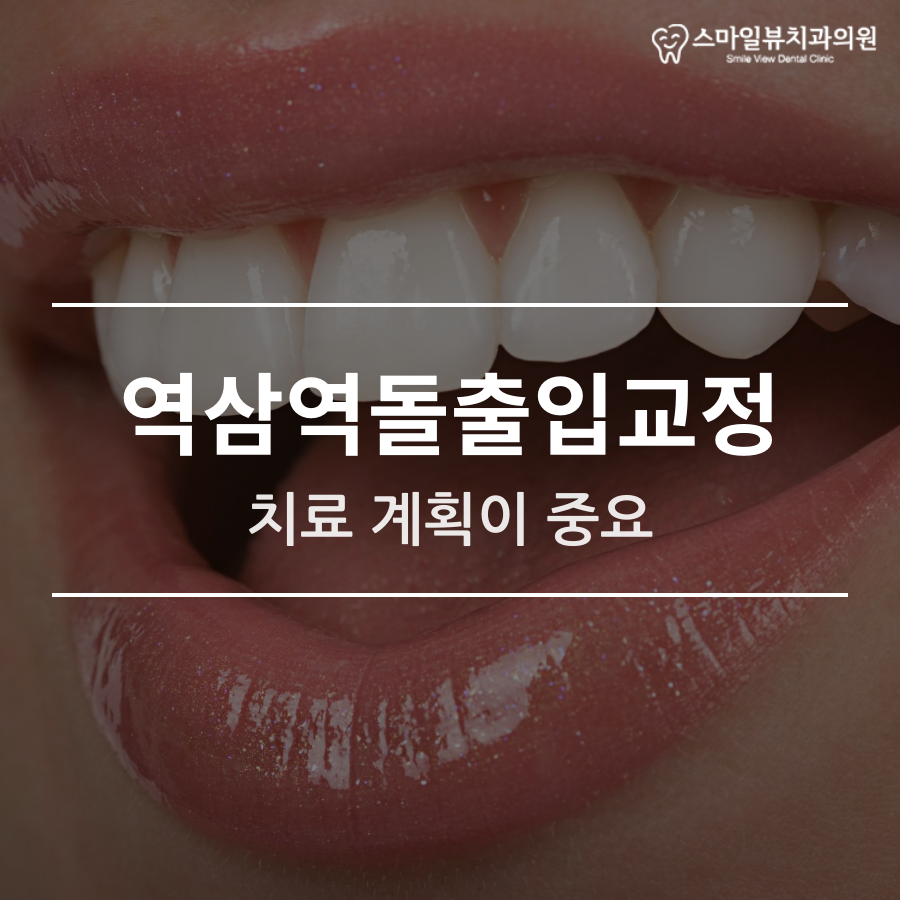 역삼역돌출입교정 치료 계획이 중요 관련 이미지 1