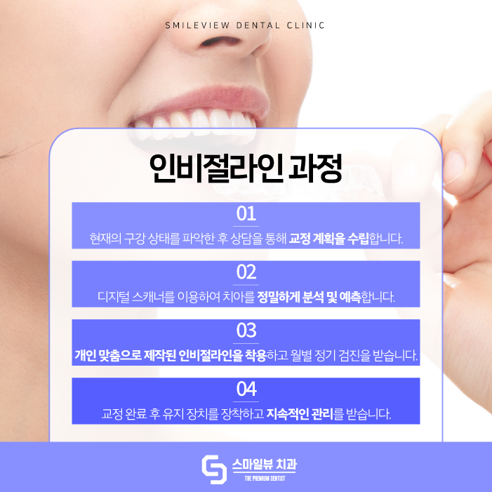 신논현역치과 인비절라인으로 투명하게 교정하고 싶다면 관련 이미지 5