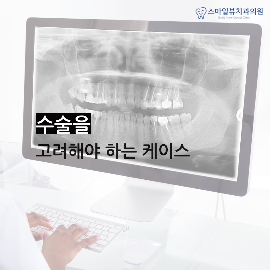 강남역치과부정교합 맞물리지 않는 치아 관련 이미지 3