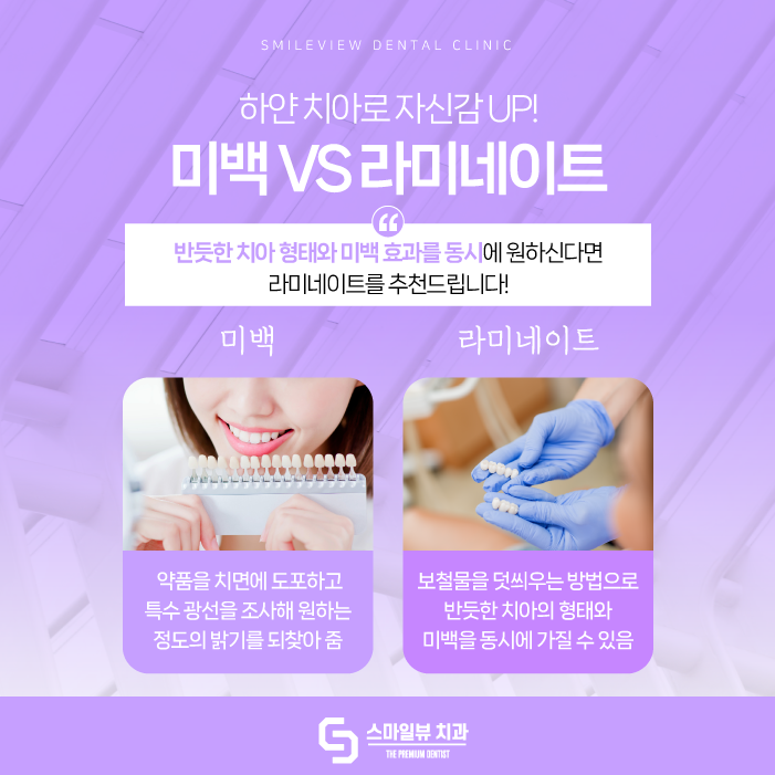 강남라미네이트치과 삭제량을 줄여 관련 이미지 3