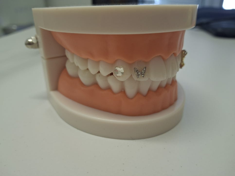 Recommended Teeth Whitening Before Chuseok! SmileView Dental Clinic at Sinnonhyeon Station image 2
