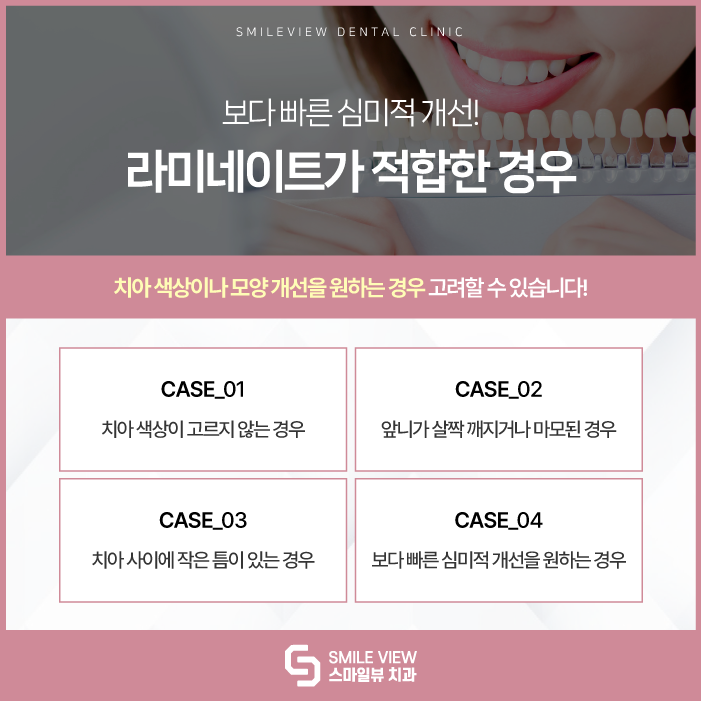 Which Is Right for Me: Nonhyeon-dong Teeth Straightening or Laminates? image 3