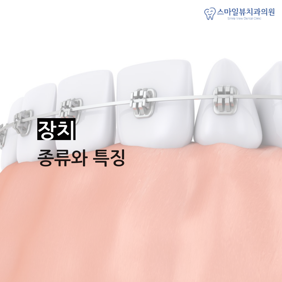 역삼역앞니교정 틀어지고 벌어졌다면? 관련 이미지 4