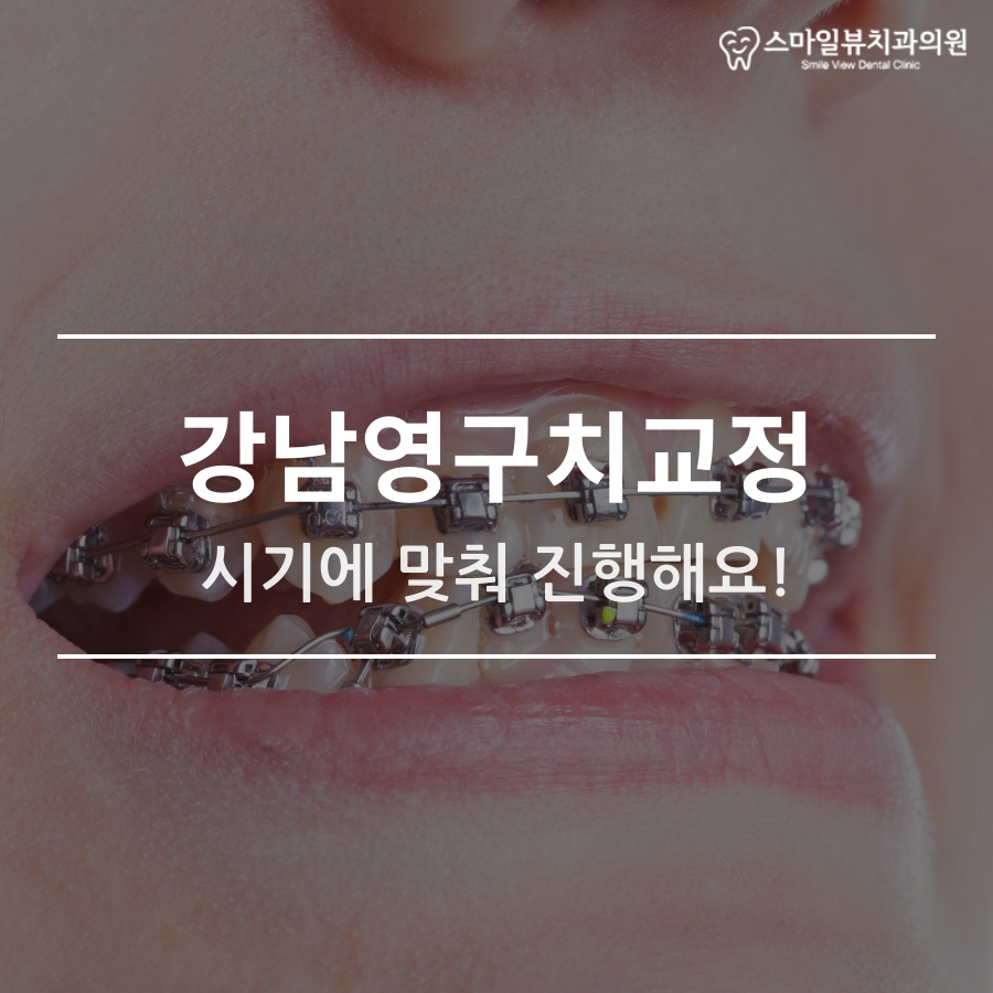 강남영구치교정 시기에 맞춰 진행해요! 관련 이미지 1