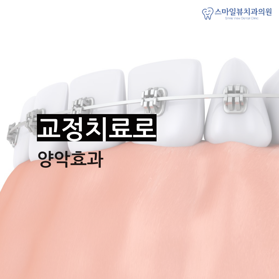 강남역돌출입 교정치료로 개선해요! 관련 이미지 3