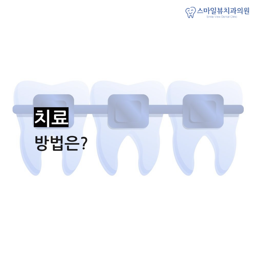 강남역치과부정교합 맞물리지 않는 치아 관련 이미지 4