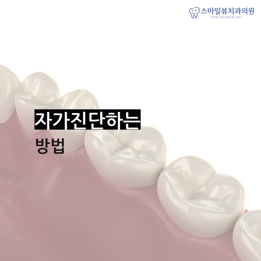 강남치과심한주걱턱 어떻게 치료하나요? 관련 이미지 3