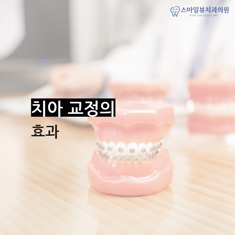 강남역돌출입수술 결정하기 전 주의사항 관련 이미지 4