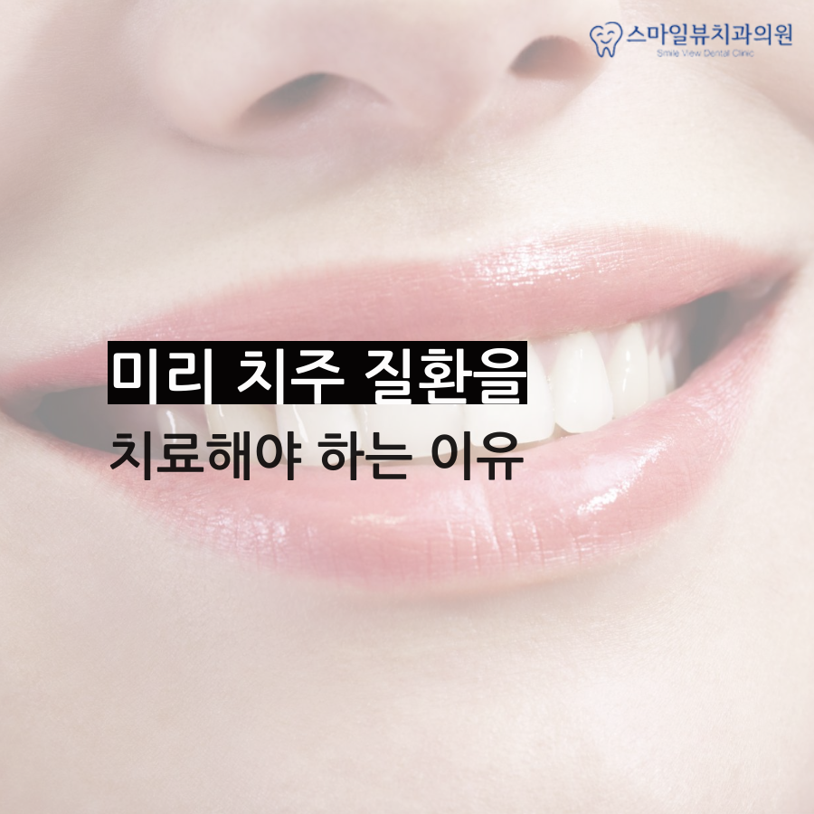 강남교정중충치 적절한 재료 선택! 관련 이미지 2