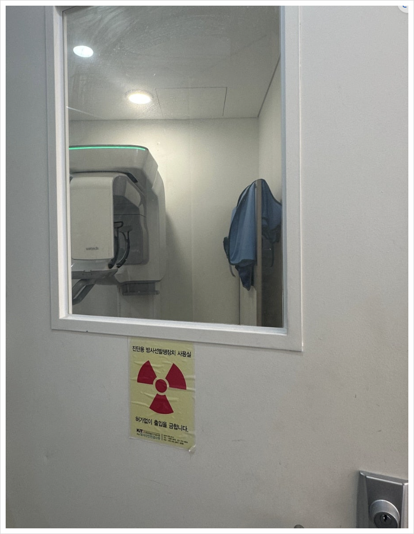 강남구 임플란트 나사 식립 통증과 풀림 후 보철물 구멍? 원인부터 정확히 알아보세요. 관련 이미지 4