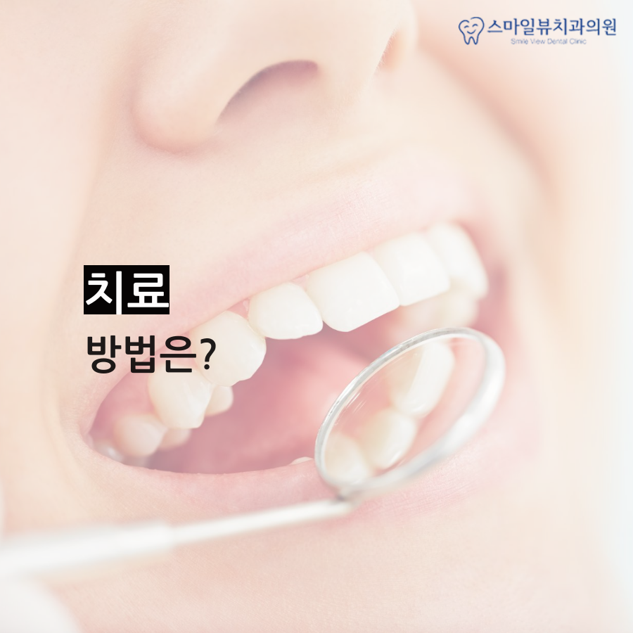 역삼치과안면비대칭 통증이 발생되기 전에 관련 이미지 4