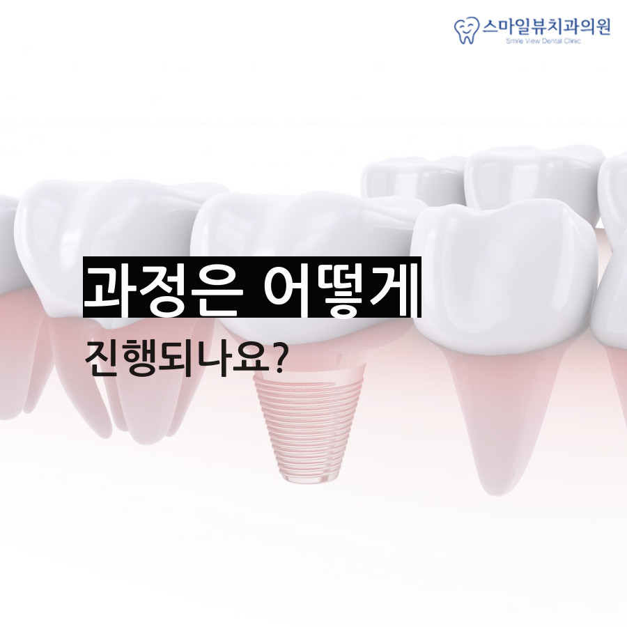 신논현역발치교정 선택은 어떻게? 관련 이미지 3