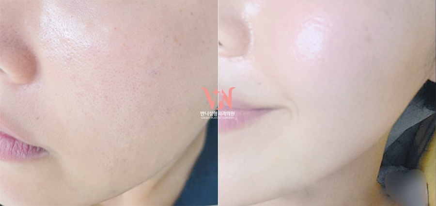 If You’ve Been Visiting a Dermatology Clinic Regularly but See No Change, the Issue May Be the Direction You’re Taking — Recommended Gangnam Dermatology Clinic Specializing in Rituo image 7