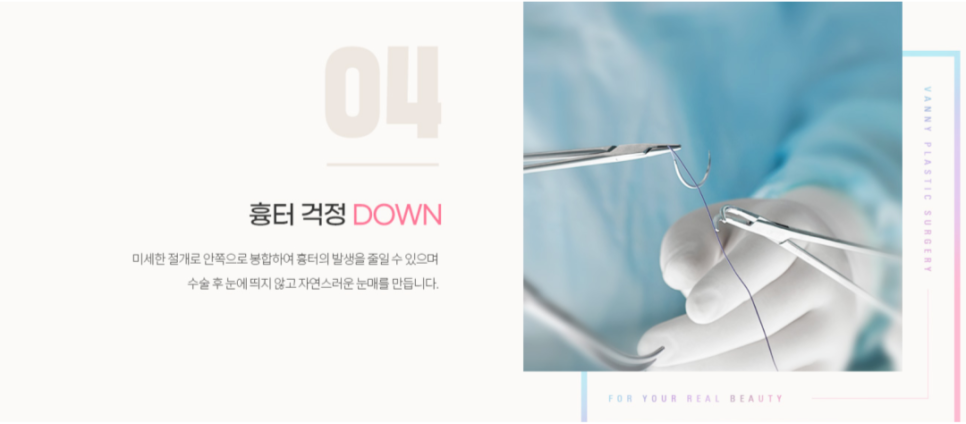 연예인 뒷트임 자연스럽게 눈매를 확장하는 방법 관련 이미지 7