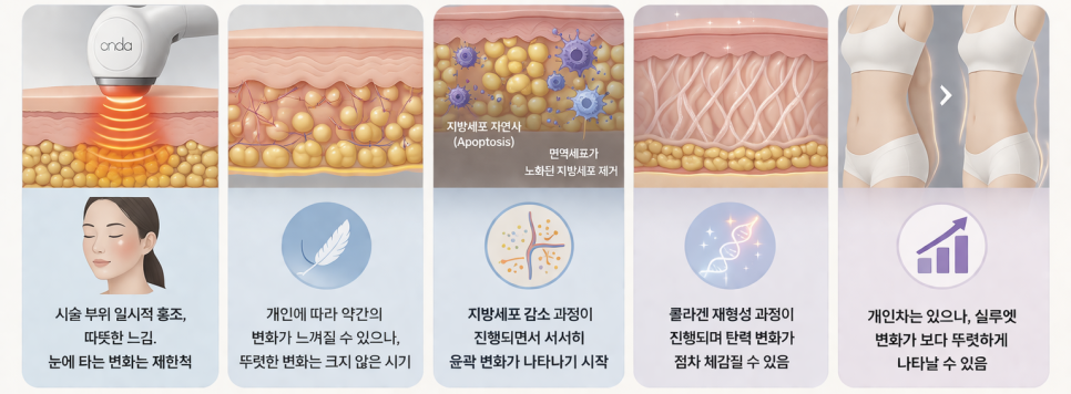 강남 온다 리프팅 망하는 가장 흔한 이유, 온다 리프팅 문의 하루 30건 받는 강남 피부과 원장이 솔직하게 말씀드립니다. 관련 이미지 25