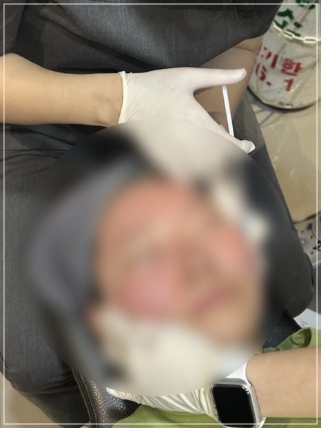 강남 수면 리쥬란 장단점과 이외 3가지 마취 옵션 특징까지 총정리 관련 이미지 3