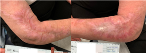 Gangnam Re2O Treatment: Controversy Over Use of Human Tissue and Side Effects? Misconceptions and Facts About Re2O. image 13