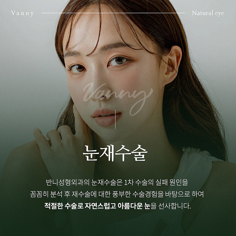 강남눈성형잘하는곳 다시 알아보게 된다면 관련 이미지 2