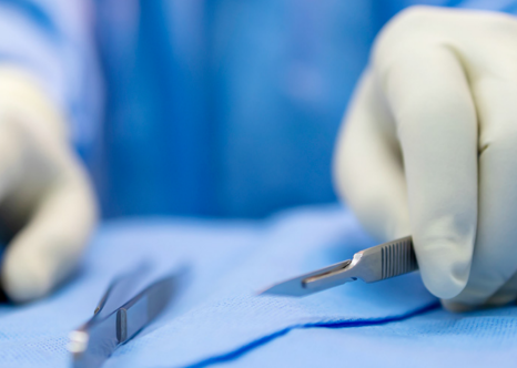 Under-Eye Fat Laser Treatment: Brightening the Eye Area Without the Burden image 7