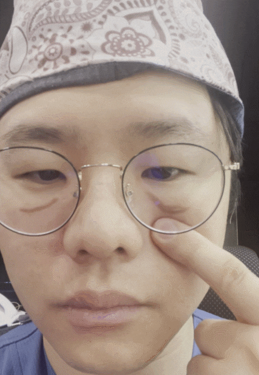눈밑지방재배치 다크서클 해결 가능? 성형외과 전문의의 솔직 의견 관련 이미지 11