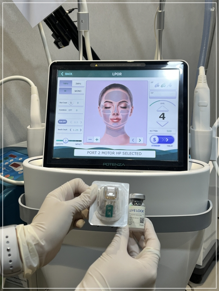 How to Reduce Pores in Gangnam: The Real Effect of Potenza Pumping Tip for Nose Pores, Explained by a Dermatology Clinic Director image 18