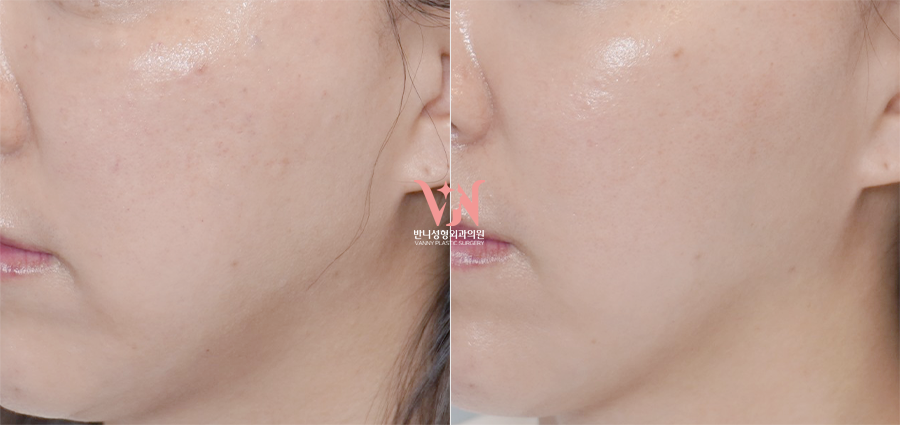 If You’ve Been Visiting a Dermatology Clinic Regularly but See No Change, the Issue May Be the Direction You’re Taking — Recommended Gangnam Dermatology Clinic Specializing in Rituo image 6