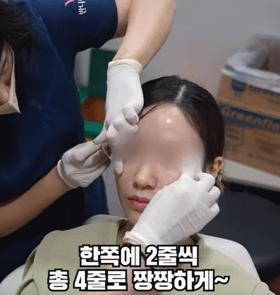 강남실리프팅 실제 디자인 과정 A부터 Z까지, 피부과 원장이 알려드림 관련 이미지 2