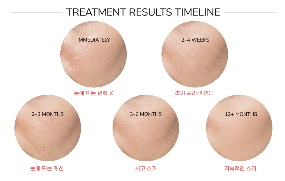 What the Reviews of Gouree Skin Booster Bought with My Own Money Say in Common image 4