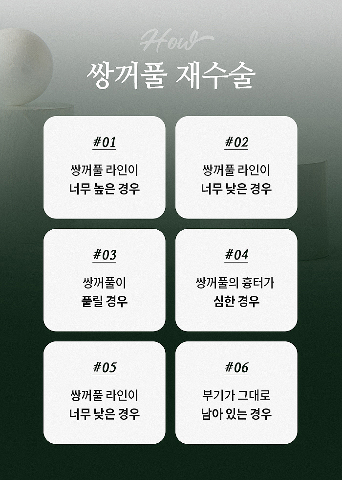 강남눈성형잘하는곳 다시 알아보게 된다면 관련 이미지 4