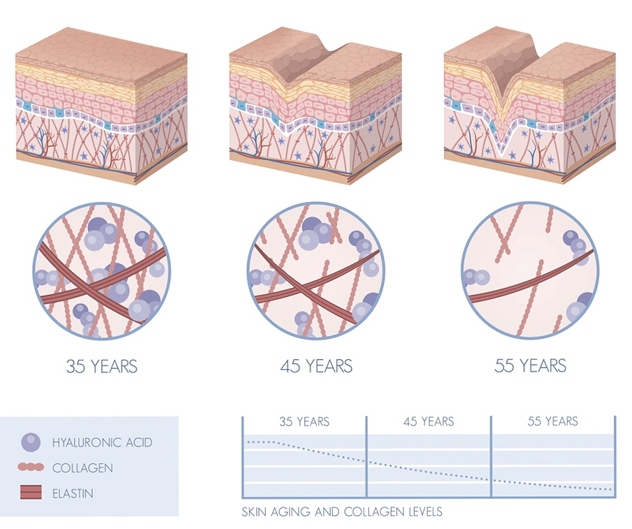When Does Ulthera Start Working? Changes After 3 Months and 6 Months (+How to Extend the Maintenance Period) image 7