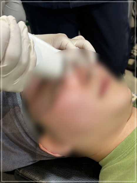 포텐자 여드름, 흉터 자국까지 하나로 올킬 가능한 이유 (+펌핑팁 효과) 관련 이미지 13