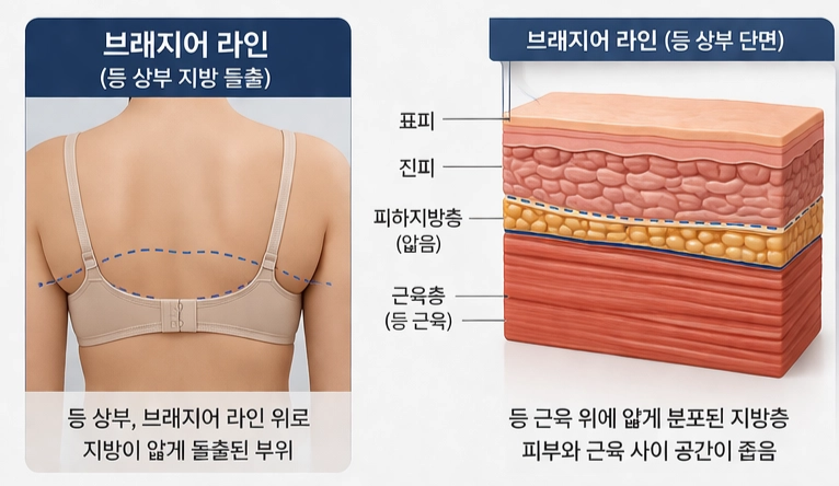강남 온다 리프팅 망하는 가장 흔한 이유, 온다 리프팅 문의 하루 30건 받는 강남 피부과 원장이 솔직하게 말씀드립니다. 관련 이미지 15